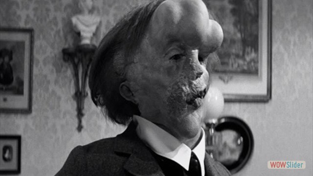  11.O Homem Elefante (1980)
